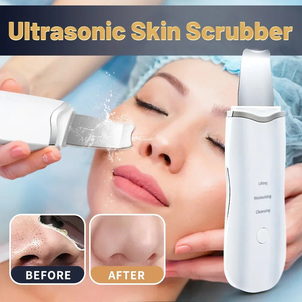 Spatule Peeling Ultrasonique – Nettoyage en Profondeur & Éclat