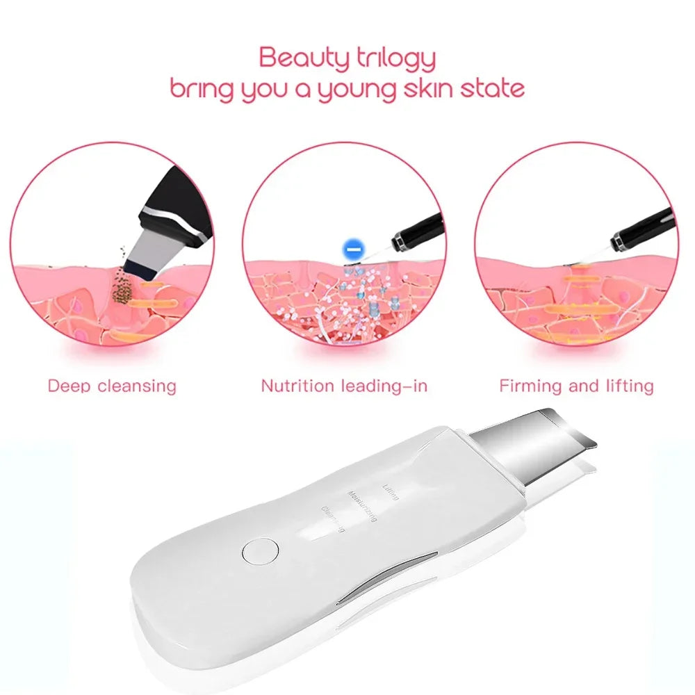 Spatule Peeling Ultrasonique – Nettoyage en Profondeur & Éclat